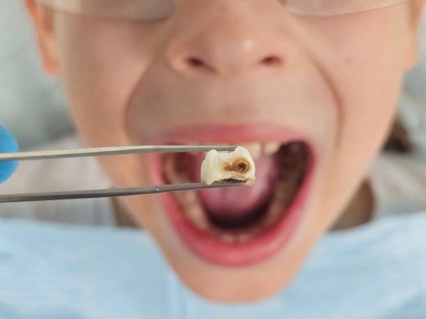 Best Weekend Emergency Dentist in Sumner, IL